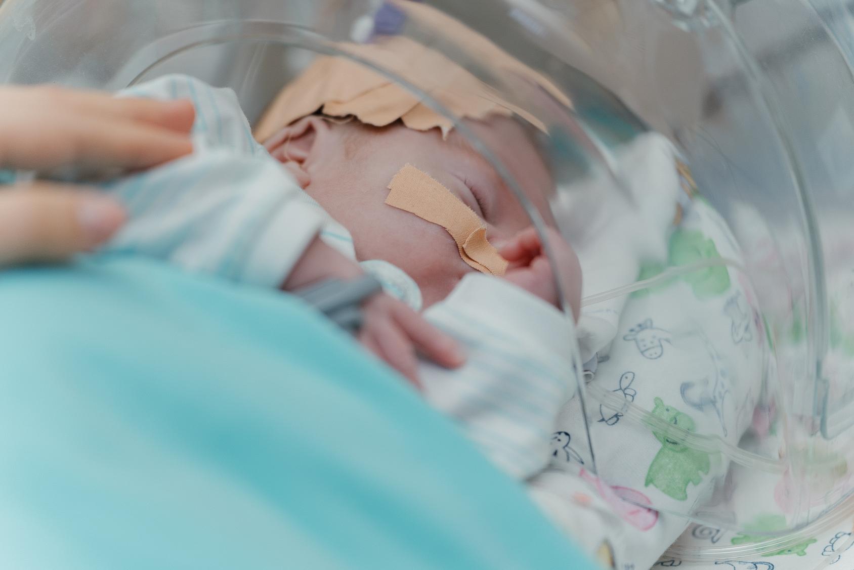 A little baby in an incubator 